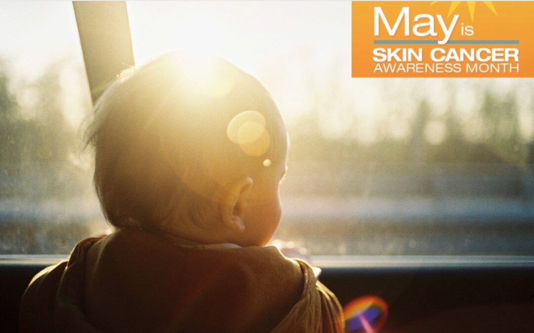 May is Skin Cancer Awareness Month - Protect Your Skin - Automotive Window Tinting in Bakersfield, California